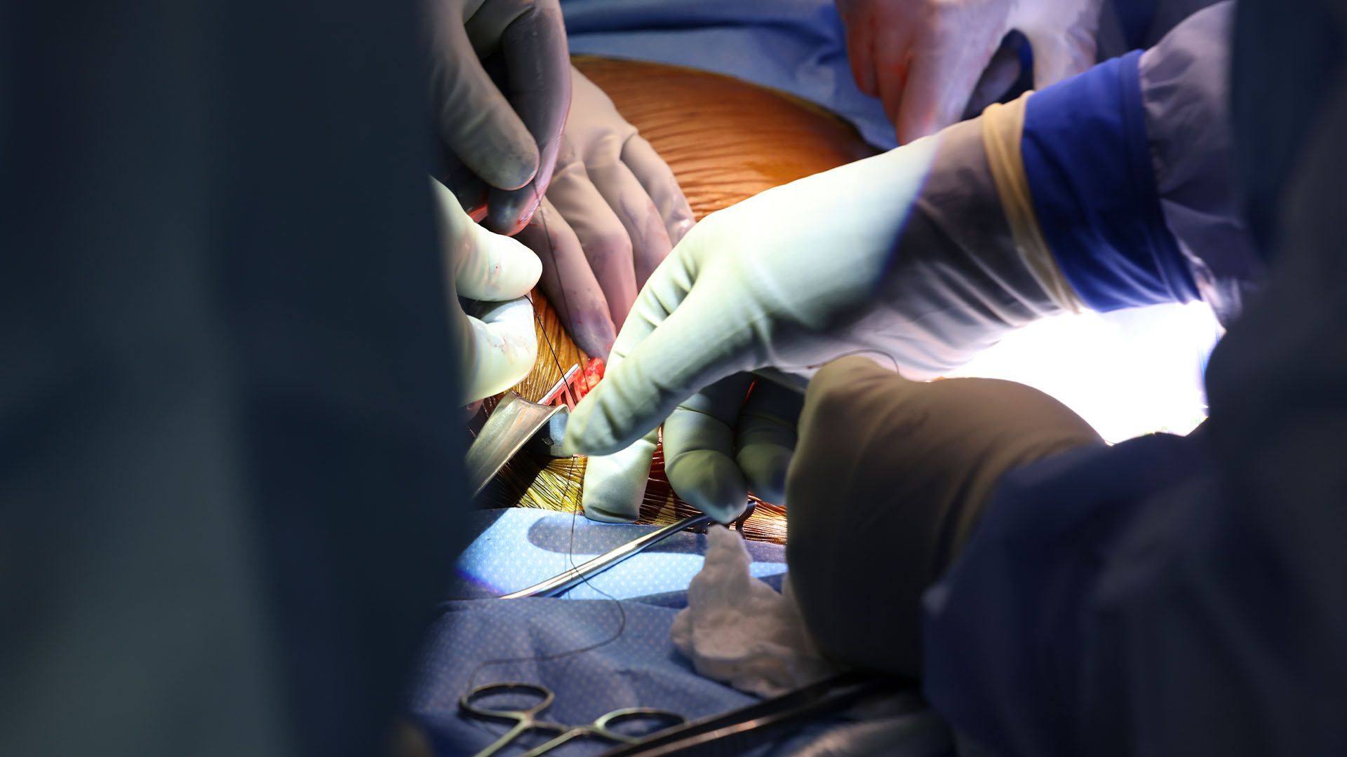 Surgeons perform the  world’s first genetically modified pig kidney transplant into a living human at  Massachusetts General Hospital.