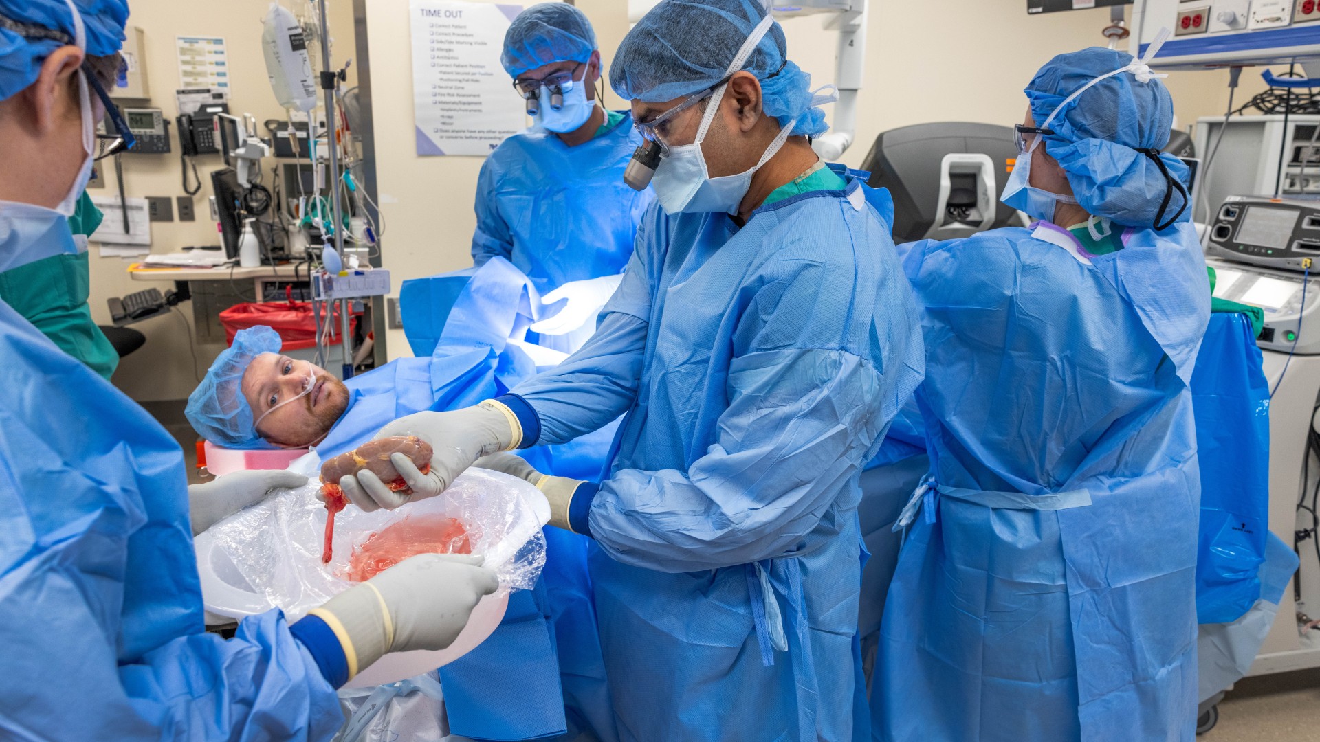 Four medical professionals are shown in the operating theater surrounding a patient who is lying down on a bed. They are all wearing blue surgical gowns, face masks and hair nets. A surgeon in the center of the image is turning away from the patient as he puts a kidney in a bowl being held by another medical professional.